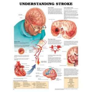 Anatomical Charts   Stroke  Industrial & Scientific
