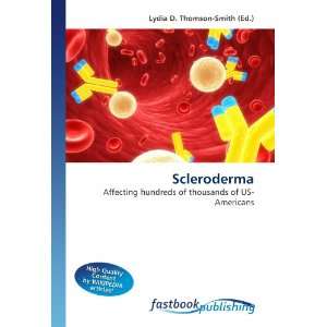 Scleroderma Affecting hundreds of thousands of US 